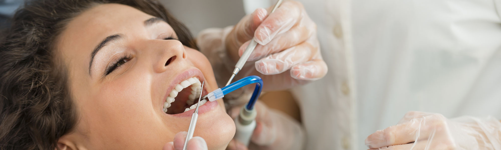 Dental Cleaning Overview