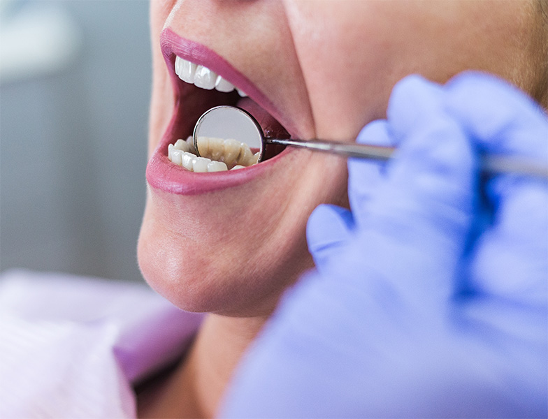 What Is a Periodontal Cleaning/Deep Cleaning/Scaling and Root Planing See Me Smile Dental Oxnard, CA